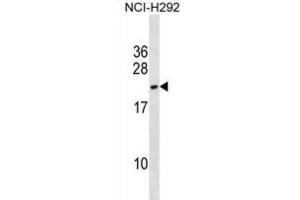 Western Blotting (WB) image for anti-DPY30 Domain Containing 2 (DYDC2) antibody (ABIN3000564)