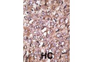 anti-Autophagy related 4A Cysteine Peptidase (ATG4A) (AA 1-30) antibody