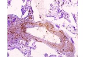Immunohistochemistry of paraffin-embedded human placenta tissue using ABIN7170369 at dilution of 1:10