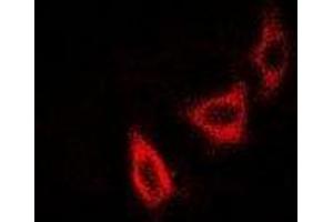 Immunofluorescent analysis of NUDE staining in SKOV3 cells.