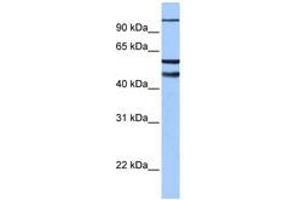 Image no. 1 for anti-Enhancer of Zeste Homolog 1 (EZH1) (AA 180-229) antibody (ABIN6742448) (EZH1 anticorps  (AA 180-229))