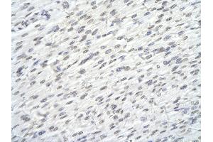 Rabbit Anti-SUPT6H antibody        Paraffin Embedded Tissue:  Human Heart cell   Cellular Data:  Epithelial cells of renal tubule  Antibody Concentration:   4. (Spt6 anticorps  (N-Term))
