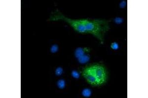 Image no. 4 for anti-Sequestosome 1 (SQSTM1) antibody (ABIN1499989)