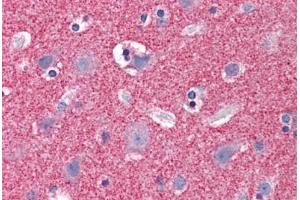 Human Brain, Cortex: Formalin-Fixed, Paraffin-Embedded (FFPE) (Septin 3 anticorps  (AA 15-26))