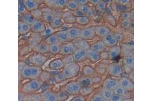 IHC-P analysis of Mouse Tissue, with DAB staining. (PIGR anticorps  (AA 352-457))