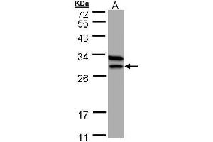 WB Image Sample (30 ug of whole cell lysate) A: MOLT4 , 12% SDS PAGE antibody diluted at 1:1000 (ETFB anticorps)