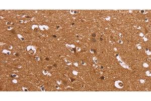 Immunohistochemistry of paraffin-embedded Human brain using HDLBP Polyclonal Antibody at dilution of 1:50 (HDLBP anticorps)