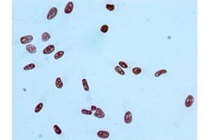 Immunocytochemistry analysis of ABIN7127265 diluted at 1:100 and staining in Hela cells performed on a Leica BondTM system.