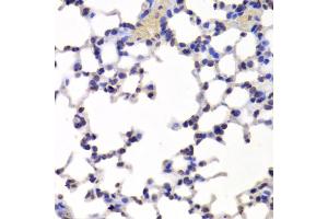 Immunohistochemistry of paraffin-embedded mouse lung using INTS6 Antibody (ABIN5973991) at dilution of 1/100 (40x lens). (INTS6 anticorps)