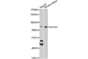 Western blot analysis of extracts of various cell lines, using ACSS2 antibody (ABIN6292756) at 1:1000 dilution. (ACSS2 anticorps)