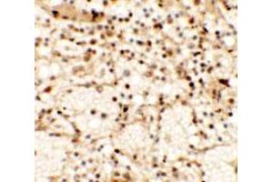 Immunohistochemical anyalysis of human spleen tissue with CLEC7A polyclonal antibody  at 5 ug/mL. (CLEC7A anticorps  (Internal Region))