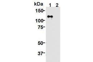 Western Blotting (WB) image for anti-Kinesin Family Member 11 (KIF11) (AA 1-1056), (N-Term) antibody (ABIN1449287) (KIF11 anticorps  (N-Term))
