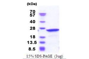 SDS-PAGE (SDS) image for Neuronal Calcium Sensor 1 (NCS1) (AA 1-190) protein (His tag) (ABIN5853871) (NCS1 Protein (AA 1-190) (His tag))