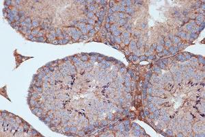 Immunohistochemistry of paraffin-embedded mouse testis using STK3/MST2 Rabbit mAb (ABIN7270223) at dilution of 1:100 (40x lens).