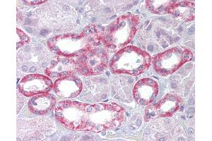 Anti-Klotho antibody IHC of human kidney.