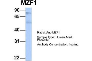 Host: Rabbit Target Name: MZF1 Sample Type: Human Adult Placenta Antibody Dilution: 1. (MZF1 anticorps  (N-Term))