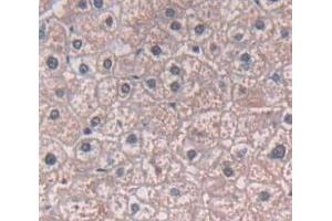 IHC-P analysis of Human Tissue, with DAB staining. (ADAM12 anticorps  (AA 513-767))