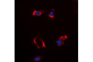 Immunofluorescent analysis of Cytochrome P450 2S1 staining in HepG2 cells. (CYP2S1 anticorps  (Center))