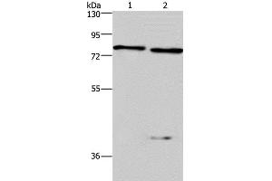 Western Blot analysis of Mouse brain and kindey tissue using COL4A3BP Polyclonal Antibody at dilution of 1:300 (COL4A3BP anticorps)