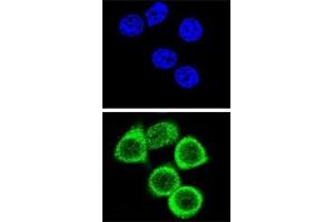 Confocal immunofluorescent analysis of PARP antibody with HeLa cells followed by Alexa Fluor 488-conjugated goat anti-rabbit lgG (green).