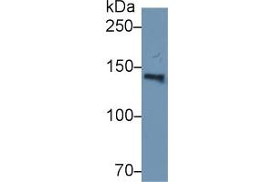 Detection of ORP150 in Human Serum using Polyclonal Antibody to 150 kDa Oxygen Regulated Protein (ORP150) (150 kDa Oxygen Regulated Protein (AA 695-994) anticorps)