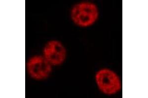 ABIN6277977 staining CoLo cells by IF/ICC. (FYB anticorps)