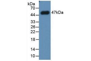 Detection of Recombinant PAI1, Human using Monoclonal Antibody to Plasminogen Activator Inhibitor 1 (PAI1) (PAI1 anticorps)