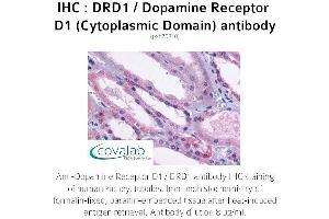 Image no. 1 for anti-Dopamine Receptor D1 (DRD1) (3rd Cytoplasmic Domain) antibody (ABIN1733780) (Dopamine Receptor d1 anticorps  (3rd Cytoplasmic Domain))