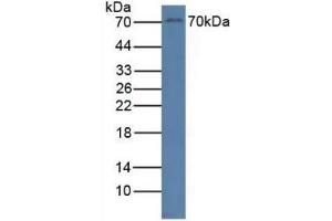 Detection of RYK in Human Jurkat Cells using Polyclonal Antibody to Related To Receptor Tyrosine Kinase (RYK)