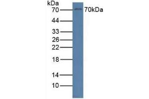 Detection of RYK in Human Jurkat Cells using Polyclonal Antibody to Related To Receptor Tyrosine Kinase (RYK) (RYK anticorps  (AA 287-533))