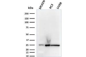 Western Blot Analysis of human spleen, PC3 and liver lysates using C1QA Mouse Monoclonal Antibody (C1QA/2783).