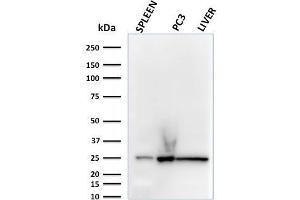 Western Blot Analysis of human spleen, PC3 and liver lysates using C1QA Mouse Monoclonal Antibody (C1QA/2783). (C1QA anticorps  (AA 104-237))