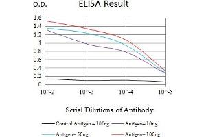 Black line: Control Antigen (100 ng),Purple line: Antigen (10 ng), Blue line: Antigen (50 ng), Red line:Antigen (100 ng) (IL18R1 anticorps  (AA 22-185))