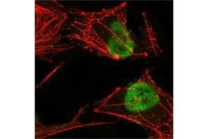 Confocal immunofluorescence analysis of Hela cells using MSH2 antibody (green), showing nuclear localization. (MSH2 anticorps)