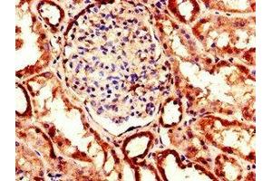 Immunohistochemistry of paraffin-embedded human kidney tissue using ABIN7151457 at dilution of 1:100 (EHD2 anticorps  (AA 401-543))