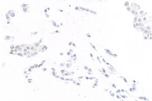 Immunocytochemistry (ICC) image for anti-ThPok (AA 250-300) antibody (ABIN7453988)