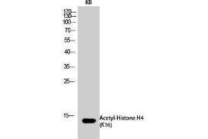Western Blotting (WB) image for anti-Histone H4 (acLys16) antibody (ABIN3179374) (Histone H4 anticorps  (acLys16))
