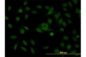 Immunofluorescence of monoclonal antibody to STAG1 on HeLa cell. (Stromal Antigen 1 anticorps  (AA 1112-1221))