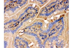 IHC analysis of IDH2 using anti-IDH2 antibody .