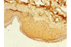 Immunohistochemistry of paraffin-embedded human skin tissue using ABIN7162495 at dilution of 1:100 (Paired Box 3 anticorps  (AA 90-184))