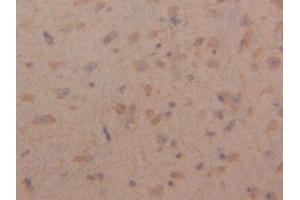 DAB staining on IHC-P; Samples: Mouse Cerebrum Tissue