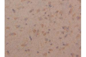 DAB staining on IHC-P; Samples: Mouse Cerebrum Tissue (Peroxiredoxin 3 anticorps  (AA 64-257))