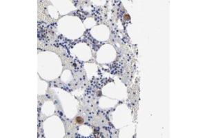 Immunohistochemical staining of human bone marrow with EMILIN1 polyclonal antibody  shows moderate cytoplasmic positivity in megakaryocytes. (Emilin1 anticorps)