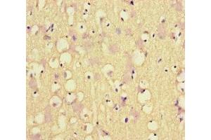 Immunohistochemistry of paraffin-embedded human brain tissue using ABIN7150201 at dilution of 1:100