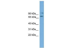 WB Suggested Anti-Eomes Antibody Titration:  0. (EOMES anticorps  (C-Term))