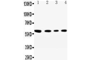 Western Blotting (WB) image for anti-Cell Adhesion Molecule 1 (CADM1) (AA 73-92), (N-Term) antibody (ABIN3042543) (CADM1 anticorps  (N-Term))