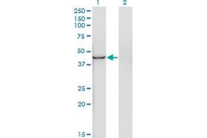 Western Blot analysis of INPP1 expression in transfected 293T cell line by INPP1 monoclonal antibody (M11), clone 4F9. (INPP1 anticorps  (AA 300-399))