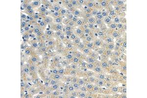 Immunohistochemistry of paraffin embedded mouse liver using CEACAM1 (ABIN7073315) at dilution of 1: 650 (400x lens) (CEACAM1 anticorps)