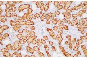 Immunohistochemistry of paraffin-embedded Rat kidney using GSTA1 Polycloanl Antibody at dilution of 1:200 (GSTA1 anticorps)