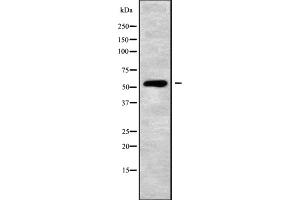 Western blot analysis of ATP6V1B2 using HT-29 whole cell lysates